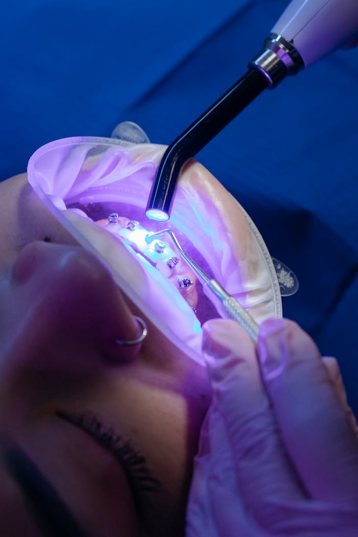 Close-up of a dental procedure using a UV light on braces for orthodontic treatment.